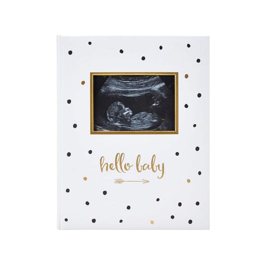 Pear Head Sonogram Baby Memory Book, Black and Gold Polka Dot (72028)