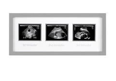 Pearhead Triple Sonogram Pregnancy Keepsake Frame, Watch Baby Grow Through all Three Trimesters - Great Gift For Expecting Parents, Grey