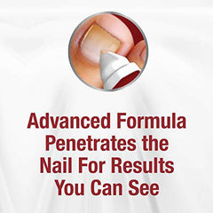 Kerasal Nail Fungal Renewal Treatment, 3 Month Supply.33 Oz by Kerasal