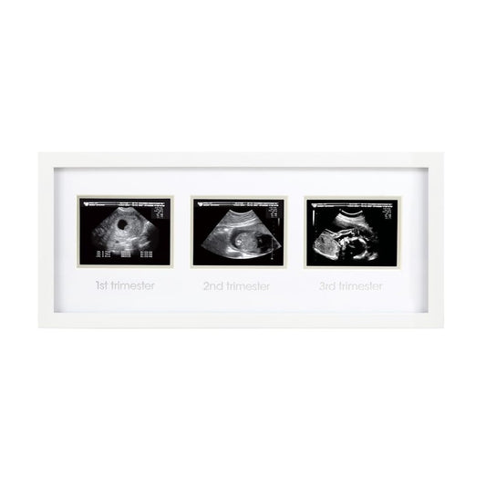 Pearhead Triple Sonogram Pregnancy Keepsake Frame, Watch Baby Grow Through all Three Trimesters - Great Gift For Expecting Parents, White