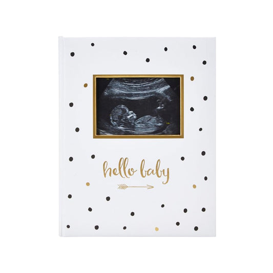 Pear Head Sonogram Baby Memory Book, Black and Gold Polka Dot (72028)
