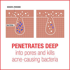 Neutrogena Stubborn Marks PM Treatment - Acne, Retinol Skin Care, Vitamin A - post-acne marks exfoliator - Fragrance Free, 29mL