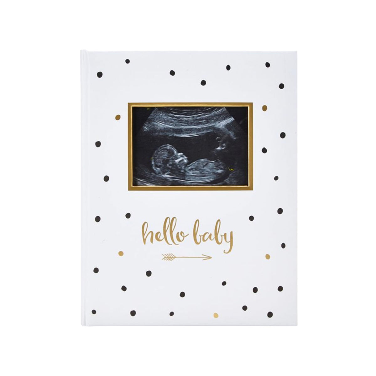 Pear Head Sonogram Baby Memory Book, Black and Gold Polka Dot (72028)