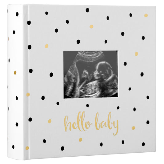 Pearhead Pearhead 'Hello Baby' Baby Photo Album, White/Black and Gold Polka Dot