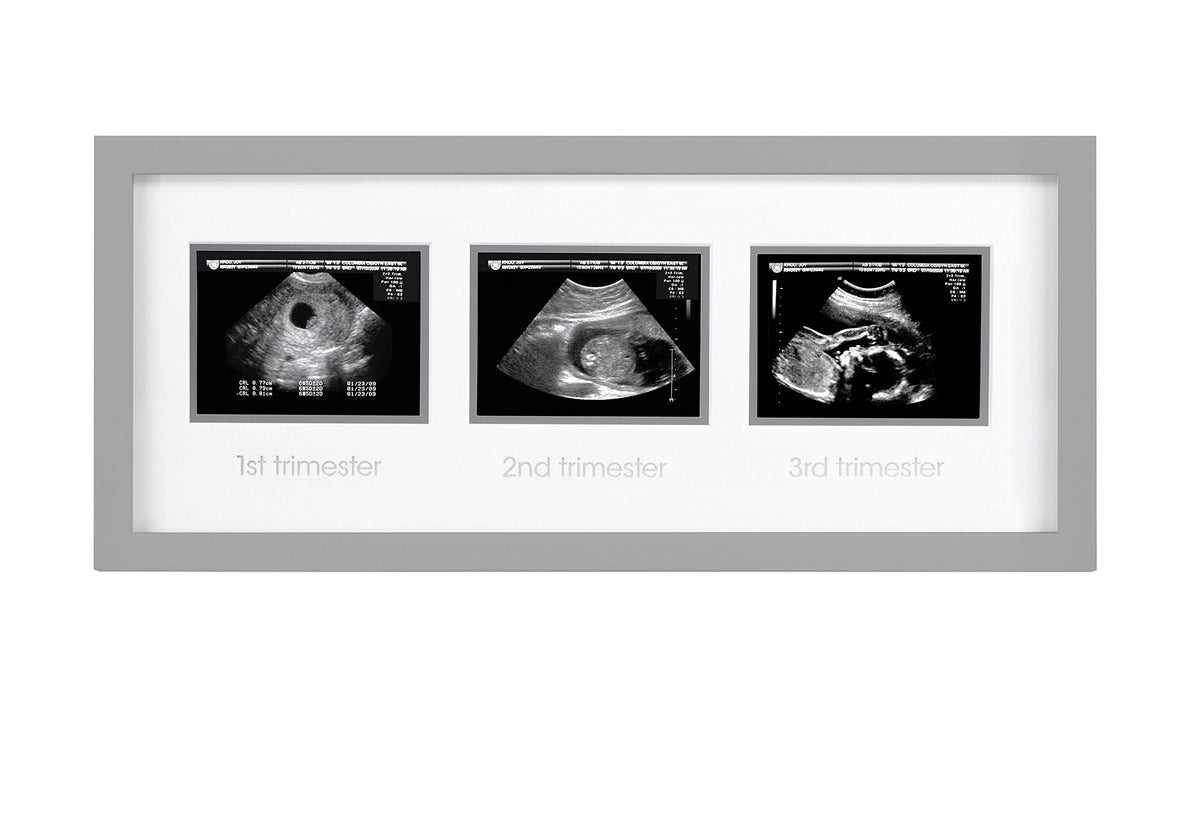 Pearhead Triple Sonogram Pregnancy Keepsake Frame, Watch Baby Grow Through all Three Trimesters - Great Gift For Expecting Parents, Grey