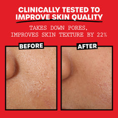 Thayers Alcohol-Free Rose Petal Witch Hazel Facial Toner for Glowing Skin, Soothing, Hydrating, Refreshing Toner for Normal and Combination Skin with Enlarged Pores, 355ml