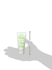 Alba Botanica Acnedote Oil Control Lotion, 57g