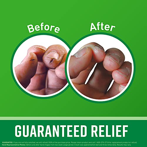 O'Keeffe's Working Hands Hand Cream, Heals, Relieves and Repairs Extremely Dry, Cracked Hands, Boosts Moisture Levels, Value Jar 6.8oz/192g, (Pack of 1) K1680004